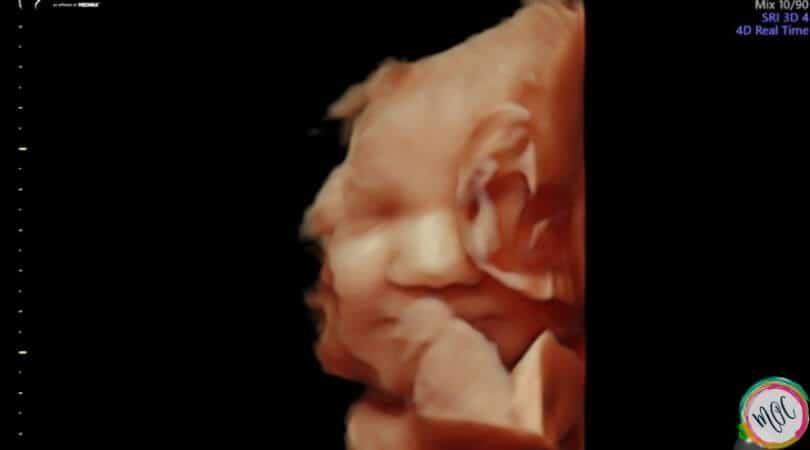 33 week pregnancy update baby in womb smiling