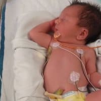 1 Week NICU Experience- Challenges and Benefits